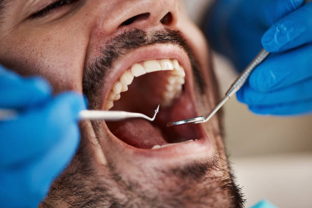 Best Tooth Pain Emergency Relief  in Garden Plain, KS