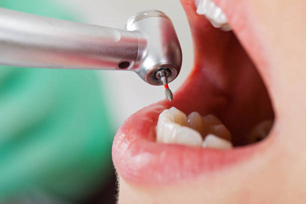 Best Urgent Tooth Repair  in Garden Plain, KS